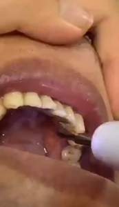 แปรงสีฟันไฟฟ้า เครื่องขูดหินปูน ขจัดคราบพลัค คราบบุหรี่ น้ำยาขจัดคราบหินปูน ชุดทำความสะอาดฟันขาว