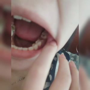 Spray Sakit Gigi gigi bengkak Semprotan pereda nyeri sakit gigi Meredakan sakit gigi gusi api Mencegah kerusakan gigi Pereda nyeri yang cepat menghambat bakteri Perawatan mulut Ini dapat digunakan oleh orang dewasa dan anak-anak