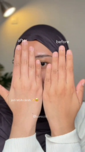 KISANA Glycolic Soap Bar - Paket Bundling isi 3pcs Sabun Pencerah Untuk Kulit Belang