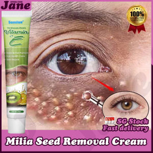 🎈𝙎𝙂 𝙎𝙩𝙤𝙘𝙠🎈 Milia seed remover / Fat granules remover eye cream / Milia seed removal cream / Milia removal eye cream / 去除脂肪粒 眼霜