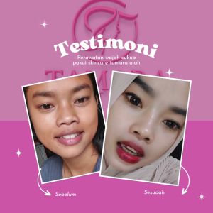 Paket Whitening Acne Tamara Beauty: Solusi Perawatan Kulit Alami