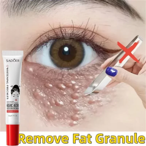 Fat Granules Remover Eye Cream Anti Puffiness Inflammatory Firm Cream Reduce Dark Circle Fade Fines Line Repair Barrier Eye Skin2026