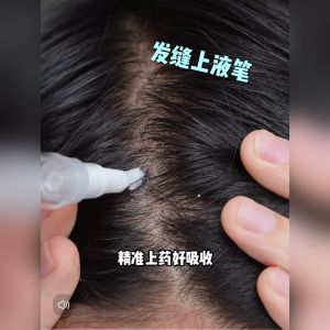 Mandi Hair Growth Serum Hair Tonic Growth Hair Serum For Hair Growth Serum Rambut Gugur  60gx1