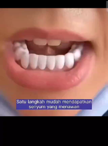 Venner White Gigi palsu palsu instan lepas pasang 100% Original