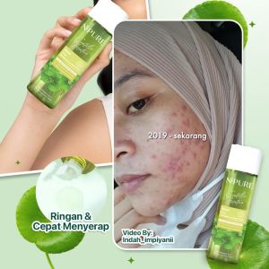 ❤️ Hayyu Beauty ❤️ NPURE Acne Face toner Centella Asiatica ( Cica Series)