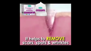 Scar Removal Cream Repairs Injured&Wounded Skin Fades Scars Reduces Stretch Marks Healing and Prevents Scar Forming Scar Repair Cream
