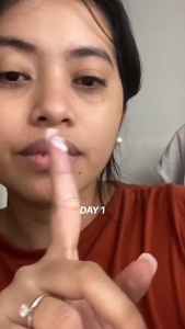 LYDIMOON Anti-Aging Redinol Eye Serum with Hyaluronic Acid for Brighter Under-Eyes & Firm Skin 35G