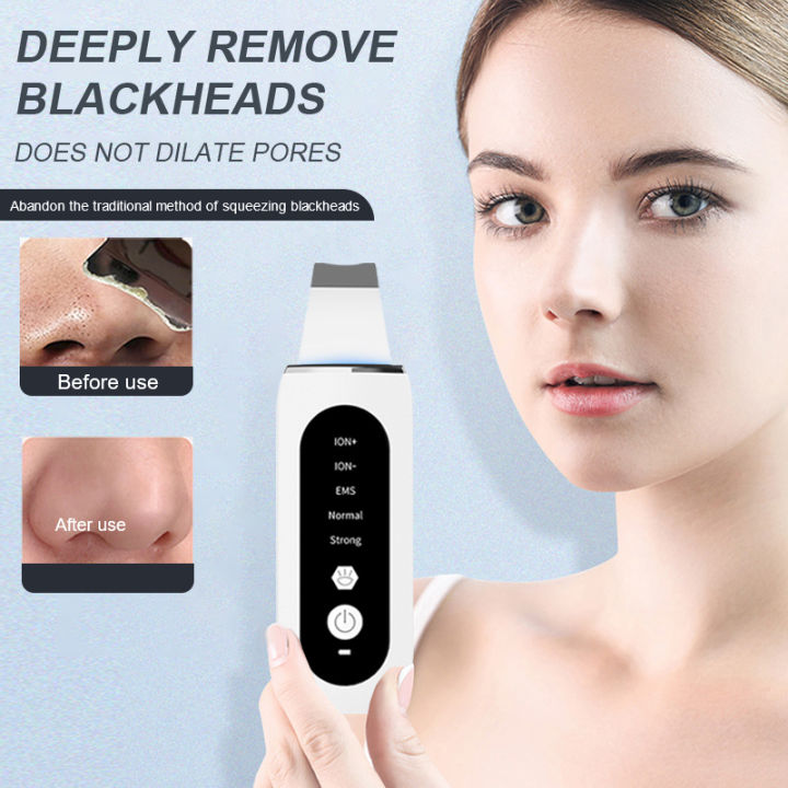 Ultrasonic skin scraper peeling blackhead remover face lifting deep ...