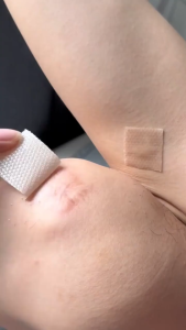 🔥ของแท้🔥 Dr.Jungle แผ่นแปะลดรอยแผลเป็น แผ่นแปะแผลเป็น ซิลิโคนลดรอยแผลเป็น เหมาะสำหรับรอยแผลเป็นใหม่และเก่า ลดรอยแผลเป็น คืนผิวเนียนใส เหมาะสำหรับแผลนูน กันน้ำ ขนาด 4*150cm