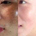 KONE FACIAL CREAM Skincare set-100% original. 