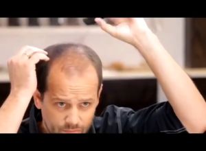 ผงปิดผมบาง ผงโรยหัวล้าน ไฟเบอร์เพิ่มผมหนา ปกปิดรอยผมบาง ใช้งานง่าย สะดวก เนียน ดูเป็นธรรมชาติ