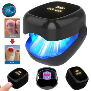 Nail Fungus Laser Treatment Device Fingernail Fungus Treat Onychomycosis Therapy Effectively Remove Onychomycosis Grow Toe Nail