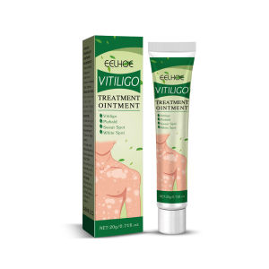 【Hot Sale】South Moon Vitligo Treatment Ointment White Spot Tag Remove Serum Cream Herbal Vitiligo Treatment Ointment Leukoplakia Ringworm Disease Reduces Repair Pigment Skin White Spot Vit-iligo Therapy Cream Ointment Antibacterial Cream Promot Liniment