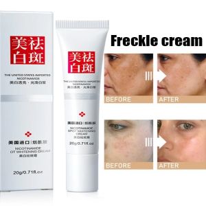 Effective Whitening Freckle Cream Remove Dark Spots Anti Freckle Cream Fade Pigmentation Melasma Brighten Creams Skin Care 20g