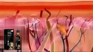 East Moon Minyak Rambut Rosemary Membaiki Rambut Kering dan Keriting Melembapkan Pemakanan Akar Rambut Penebalan Menguatkan Minyak Pati