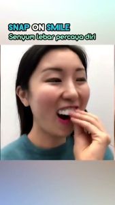 Gigi Palsu Lepas Pasang Atas Bawah Instan Snap On Smile 100% Original Removable Veneer Teeth