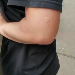 Hộp Đựng Nhang Muỗi Di Động Xoay Được Có Thể Điều Chỉnh Treo Nhà Bằng Thép Không Gỉ