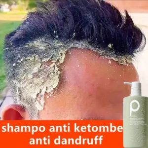 LIFUSHAShampo anti ketombe Shampo rambut rontok mite removal Shampo penumbuh rambut cepat Jahe ketombe / oil control 500ml