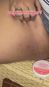 Underarm Whitening Brightening Cream Bleaching Body Lightening Cream Permanent Underarm Whitening Private Armpit Body Cream Legs Whitening Parts Cream Kneesremoving melanin without rebound 25G 美白霜