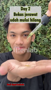 (Bisa COD FREE ONGKIR) Serum Menlab Hydrating Skin Wajah Pria Skincare Cowok Glowing Wajah Bpom Original Serum Pemutih dan Pencerah Perawatan Viral