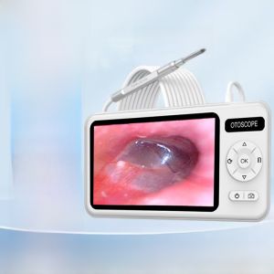 Professional High Definition Ear Cleaning Instrument Visual Ear Digging Tool for Ear Nose Throat Inspection Non-Disposable