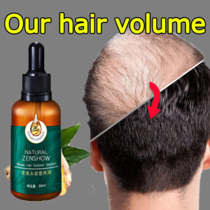 penumbuh rambut Hair growth serum penumbuh rambut botak serum penumbuh rambut 30ml serum rambut rontok Penumbuh Rambut
