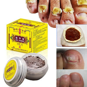 Repair Grey Nails Repair Essence Anti-Infection Nail Fungus Barb Thickening Toenail Care Thickening Grey Nails Beauty Nail
