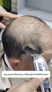 【รับประกัน 5 ปี】แบตตาเลียน ตัดผม แถมของขวัญ 14 ชิ้น กันหนีบผมอัจฉริยะ ใบมีดปลอดเชื้อ 9D อัพเกรดแบตเตอรี่ หัวใบมีดเซรามิกไวเบรเนียม ปัตตาเลียน ตตาเลี่ยนผม ปัตตาเลี่ยนตัดผม เครื่องตัดผม ปัตตาเลื่อนไร้สาย ปัตตาเลื่อนแบบมืออาชีพ ที่ตัดผมไฟฟ้า