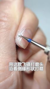 Ufo Mini Funnel-Shaped Grinding Head Remove Overflowing Glue On Both Sides Trimming Barbed Dead Skin Side Edge飞碟迷你漏斗形打磨头