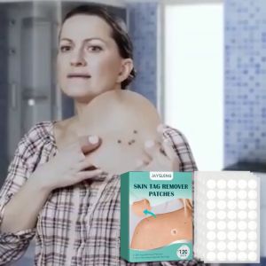 Skin Tag Removal Wart Removal Ubat Ketuat Buang Tahi Lalat Remover Skin Tag Remover Patch Mole Remover Wart Removal Safe Painless 120pcs
