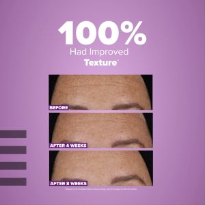 Paulas Choice PRO Retinaldehyde Treatment | High Potency Retinoid  Anti-Aging Improves Skin Luminosity