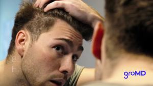 Hair Loss Serum Hair Growth Treatment Regrowth Follicle Activator Spray Argan Oil Biotin & Caffeine Thickening Doctor Developed DHT Blocking Ingredients 60 Day Supply