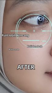 𝐁𝐔𝐘 𝟏 𝐅𝐑𝐄𝐄 𝟐 𝐋𝐚𝐥𝐨𝐭𝐮𝐬𝐤𝐢𝐧 Clearskin Treatment Serum With DNA Salmon Dan Retinol