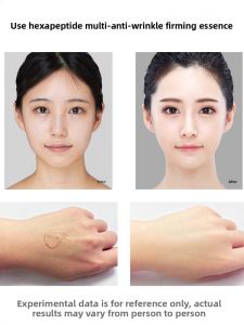 ORKY | Anti-Wrinkle Facial Lifting Essence Tightening and Reducing Fine Lines