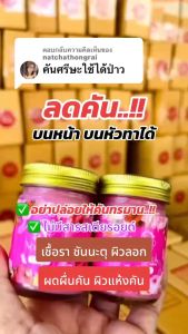 พร้อมส่งแท้100% 1แถม1 บาล์มนงลักษณ์ บาล์มชมพู คัน กลาก เกลื้อน เชื้อรา บนหน้าเเละหัว