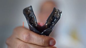 Shock Doctor Pro Sports ฟันยางรุ่นเบสิค |Official Shop| ฟันยางนักมวย บาส นักกีฬา mouthguard mouth guard