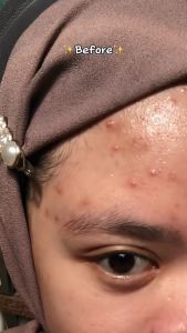 Bening Facial Wash Brightening Benings Skincare by dr Oky Pratama - Bening Clinic