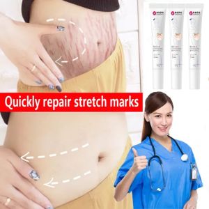 Pregnancy Repair Cream Scar and Stretch Mark Remover Cream Anti Wrinkle Anti Aging Maternity Skin Repair Remove Pregnancy Scars Body Skin Care 20g