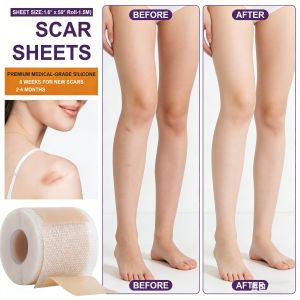Silicone Scar Sheets Patch Scar Removal Strips for Surgical Painless Scar Repair Tape Roll Effective Scar Removal Strips for C-Section Keloid Burn Acne 