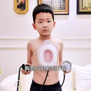 ZHONGLIANG | Pectus Excavatum Correction Negative Pressure Breast Support Adult & Child