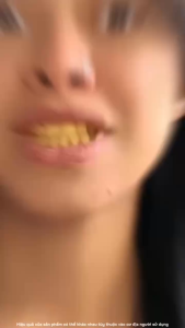 [SIÊU HOT] Kem Đánh Răng Làm Trắng Răng Tấy Những Vàng Răng Cao Răng Cứng Đầu Ngừa Sạch Sâu Thơm Mát