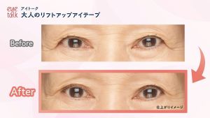 NEW Koji Eyetalk Ageless Eye Lifting Tape 70s #07602