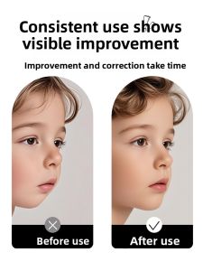 Oral Breathing Correction Trainer for Children