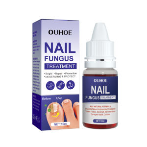 Ouhoe Nail Fungus Treatments Serum Cream Anti Fungal Foot Toe Nails Repair Gel Anti-Infection Onychomycosis Paronychia Care Ointment Repairing And Thickening Nail Inlay Gray Nail Bright Nail Soft Nail Care Solution 10ml