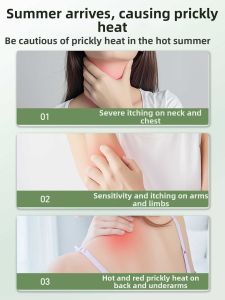 BANPINGHUA | Adult Anti-Heat Rash Spray