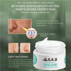 Freckle Cream Removing Melanin Dark Spots Pigmentation Melasma Moisturizing Brightening Skin Tone 20g