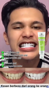 Pasta Gigi Pemutih Probiotik  Pasta gigi 120g menghilangkan karang gigi efektif menyegarkan napas mencegah gigi berlubang  Membuat gigi lebih putih