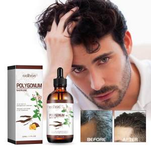 Polygonum multiflorum essence nourishes the hair roots reduces dryness smoothes the hair