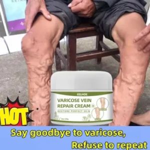 Krim Penghilang Varises Kaki Eelhoe: Solusi Aman & Efektif