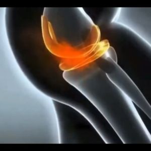 Plester Koyo Untuk Nyeri Sendi Lutut Kaki 2 pcs